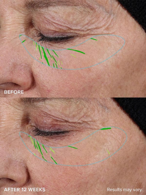 Needle-less Growth Factor Serum - Image 4