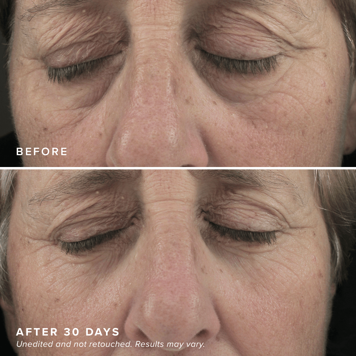 Brightening Eye Masks - Image 7