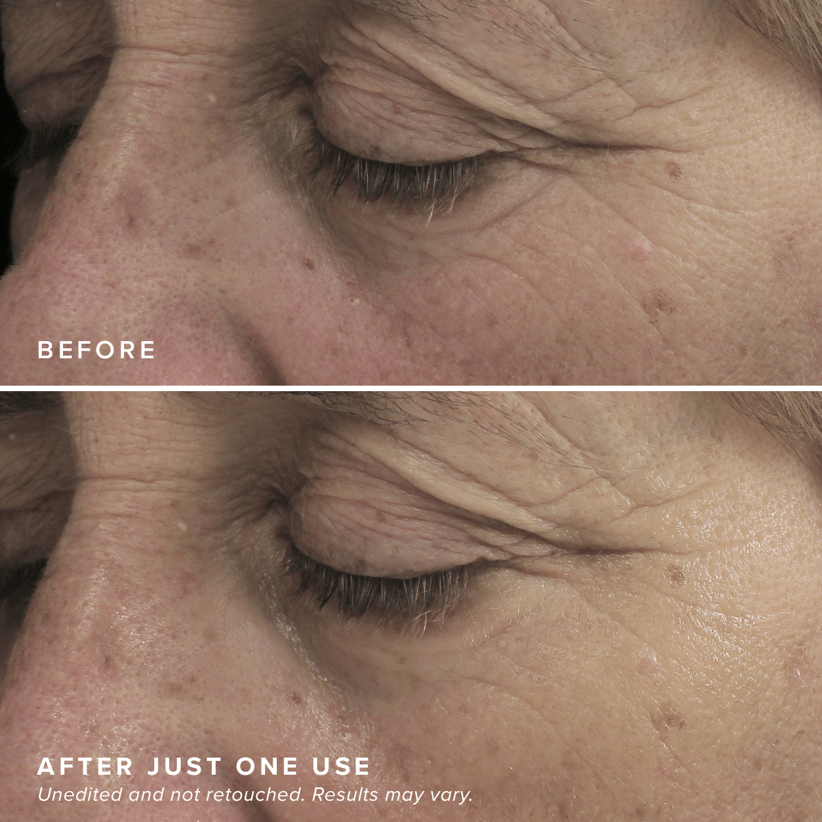 Brightening Eye Masks - Image 6